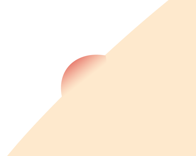 皮膚腫瘍